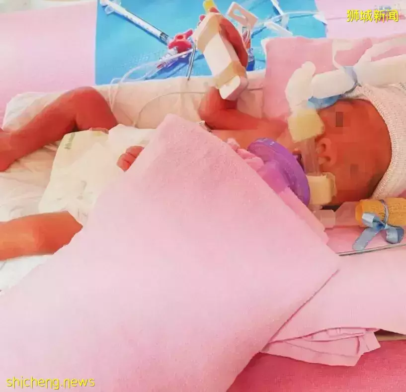 新加坡华人妈妈全网求助，宝宝得怪病、体重一公斤、皮肤近透明