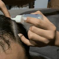 獅城這些“禿”如其來的煩惱,讓它幫你解決