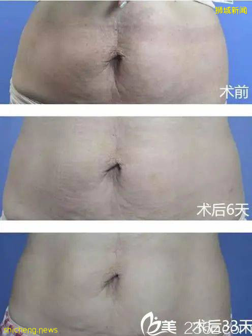 新加坡童年女神隐婚10年，41岁嫁富豪老公，50岁美成了天仙