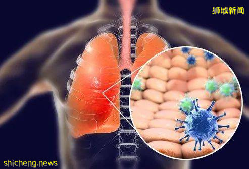 網上瘋傳:新加坡對新冠病人屍檢後修改治療方案