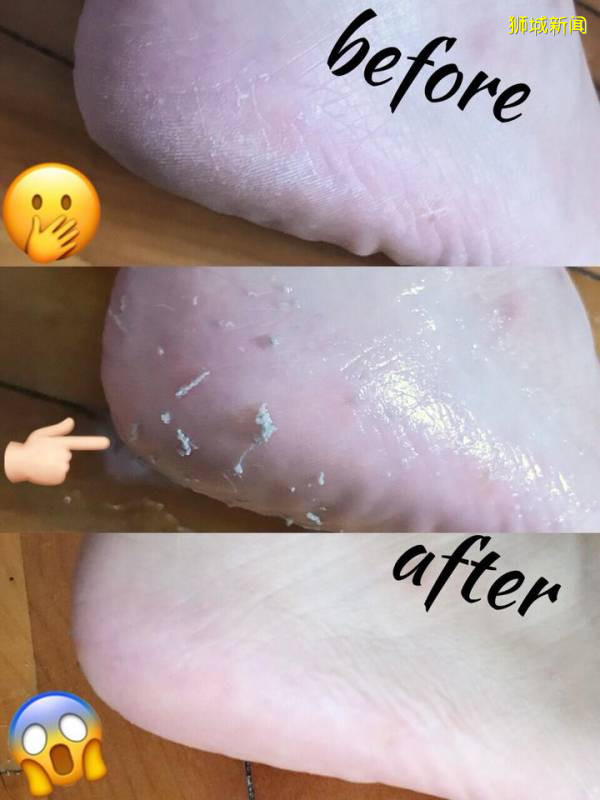 超劃算的去角質噴霧、植物酵素、斷貨面膜!去日本才買得到的神奇好物集體上架新加坡官方旗艦店啦