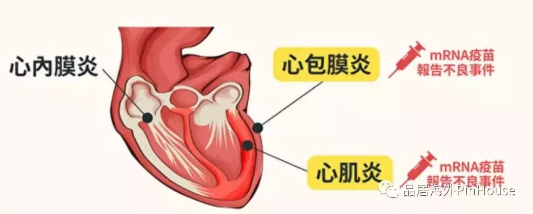 新加坡5~12歲幼兒開打疫苗啦~家長最關心的問題全解析