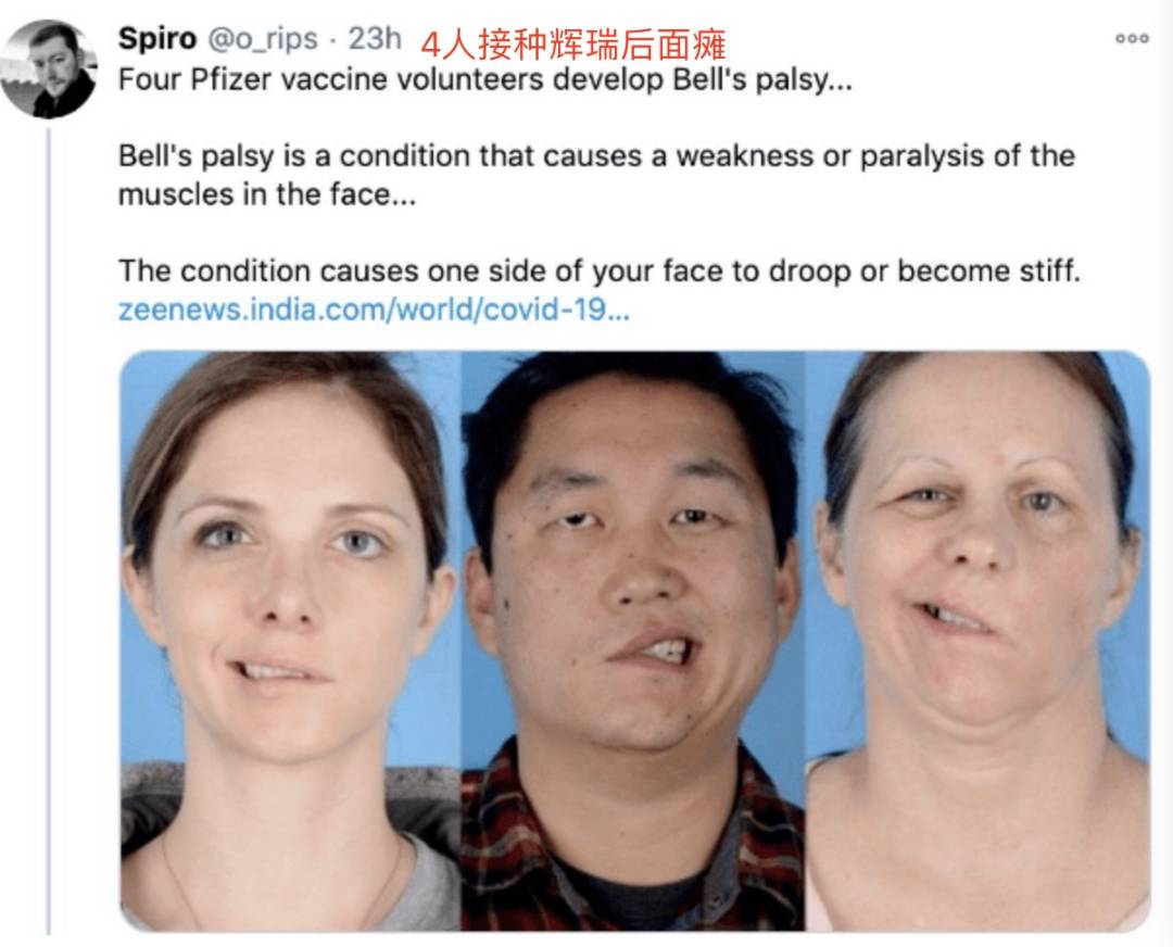 72歲老人接種疫苗後心髒驟停、生死不明!衛生部回應了