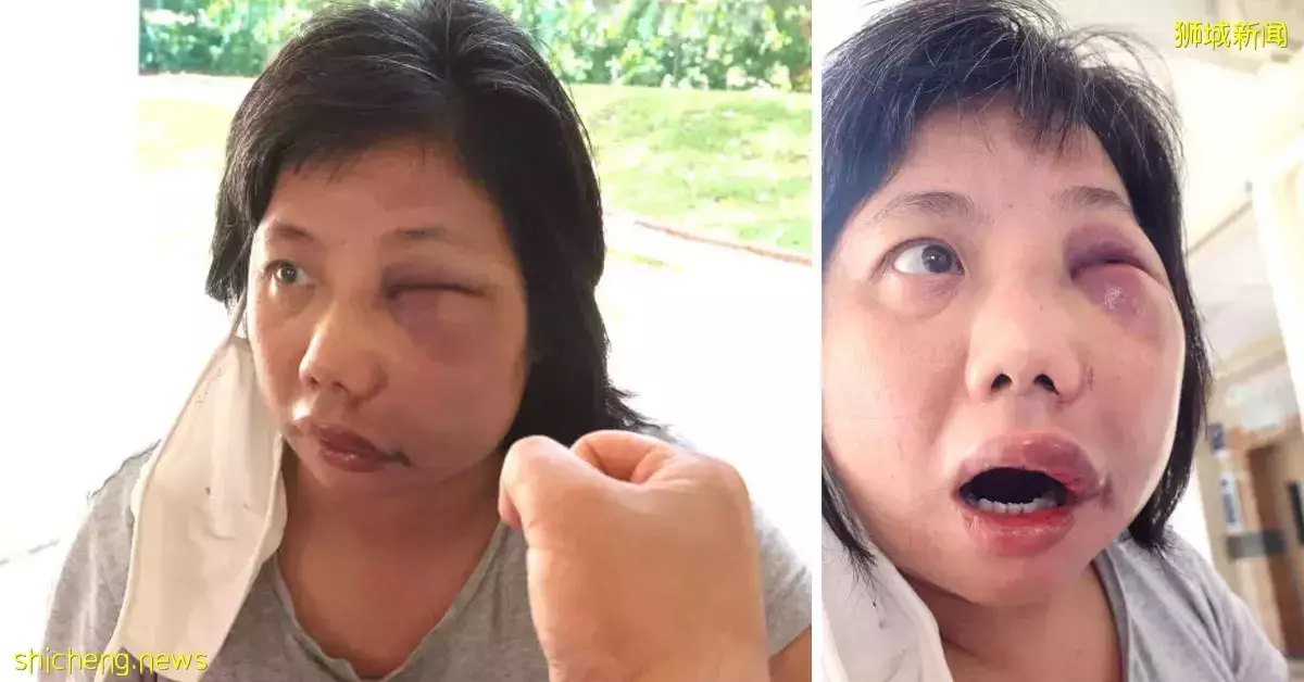 女送餐员险被撞 喊一声“喂” 捱5拳