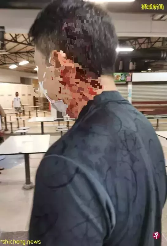 遭老摊贩以螺钉木棍袭击 男子头破流血送院缝9针