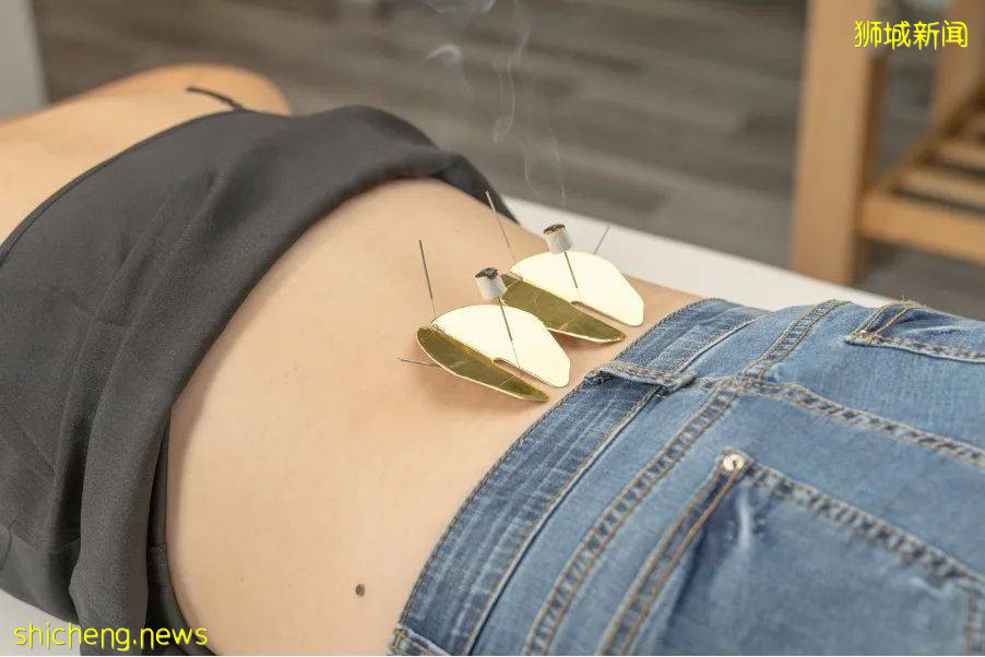 美女中医师坐镇,新加坡特色中医项目等你体验