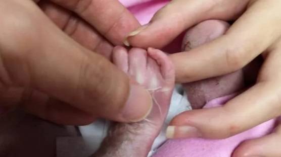 经历30小时生产 女儿竟夭折 母欣慰义工制衣 让宝宝漂亮离开