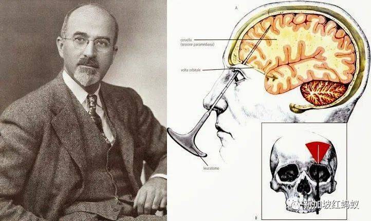 新加坡醫生：必須尊重每一個精神病患者，生病並非他們的錯