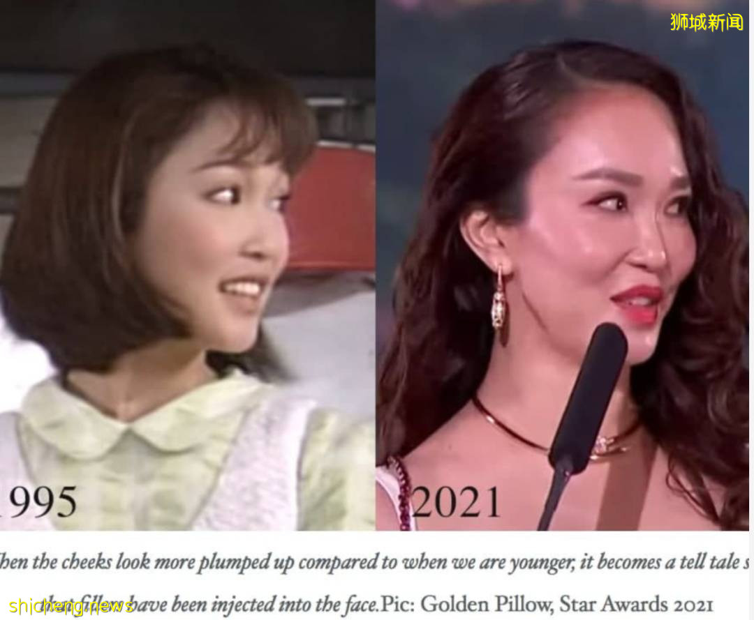 新加坡明星范文芳整容了？整容医生说错话，被发律师信