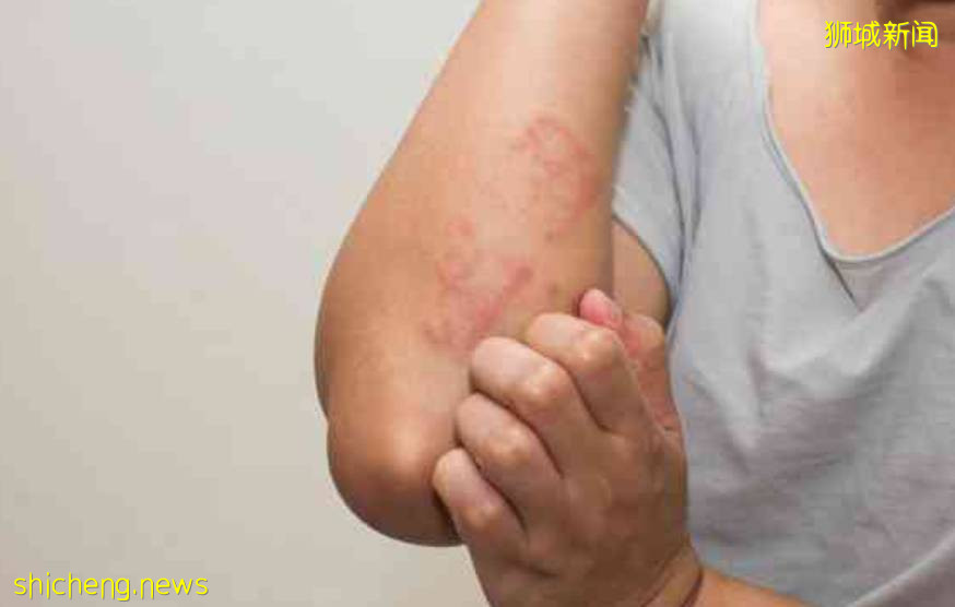 科興來了！新加坡網友：能優先入境中國，多少錢都打！女生混打科興和輝瑞，結果