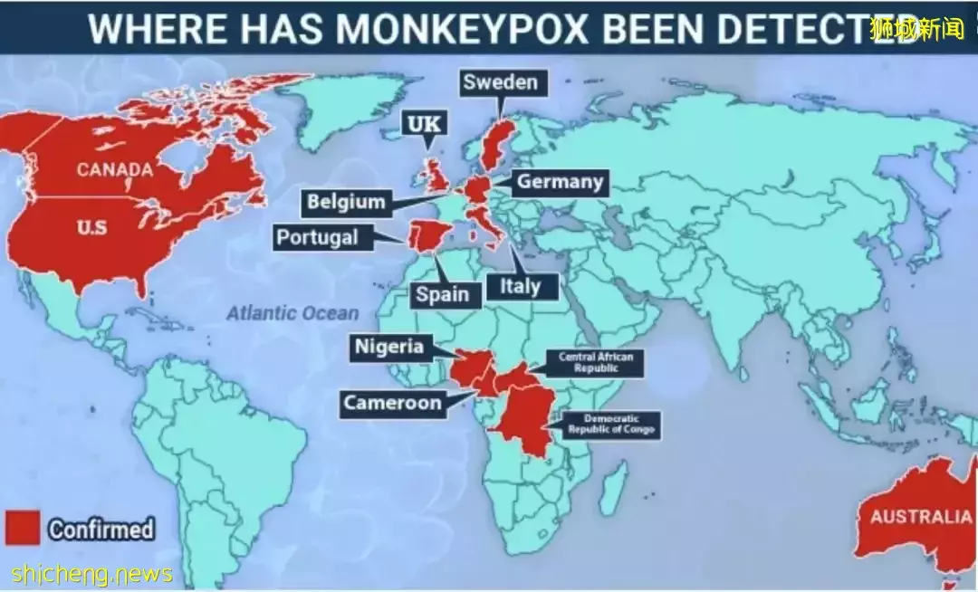 突發!新加坡組屋現不明肺結核感染群,2人死亡!多國曝“新冠+天花”病例,人畜共通