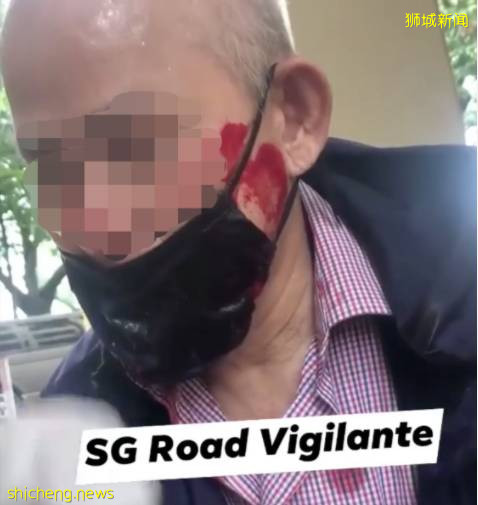 老人被电动车撞倒口罩都沾满了血,热心路人甲上线