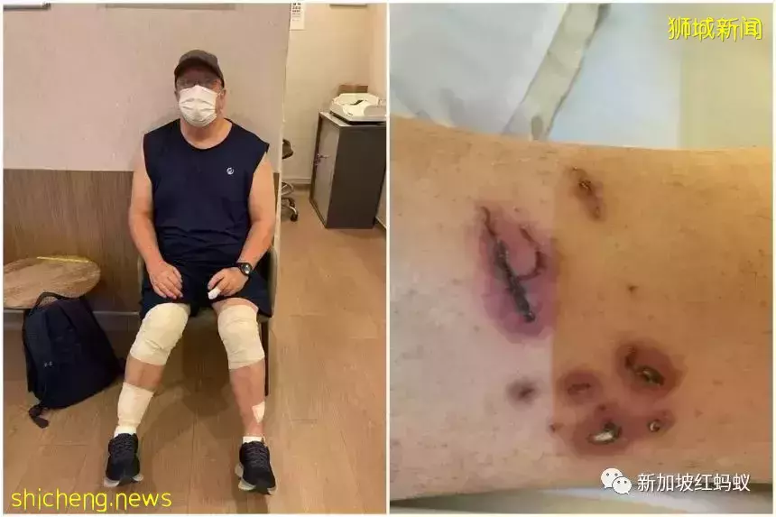 新加坡接连发生孔雀水獭伤人事件，引发舆论激辩到底该如何与野生动物共处