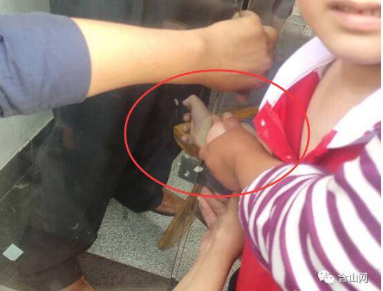 新加坡女童手臂在家中被玻璃門夾斷，家中“隱形殺器”不容忽視