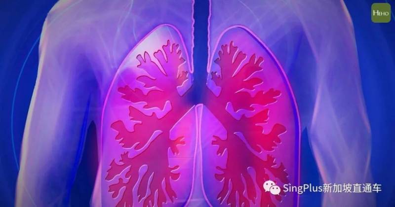 新冠還未過去，更可怕的“新冠後遺症”悄然降臨！新加坡已有客工出現症狀