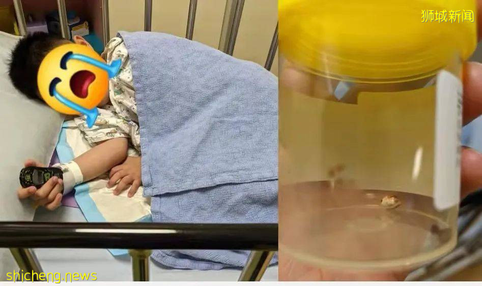 新加坡熊孩子太让人操心，一颗卵石跑进耳朵花费千元取出