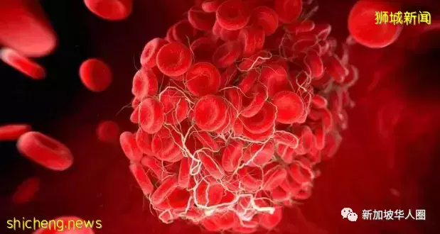 新加坡15995人接種疫苗出現副作用，10名小孩出現嚴重不良反應