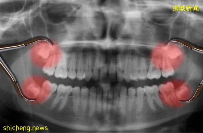 羡慕了，中国十多个省市养老金17连涨！！而新加坡的养老却