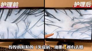 脫發救星來了！不到一折價格體驗新加坡最頂尖的防脫發服務，超級值