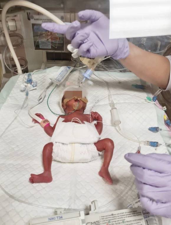 新加坡看病太贵:她的早产儿账单40万新币!女佣病危雇主要花15万新币