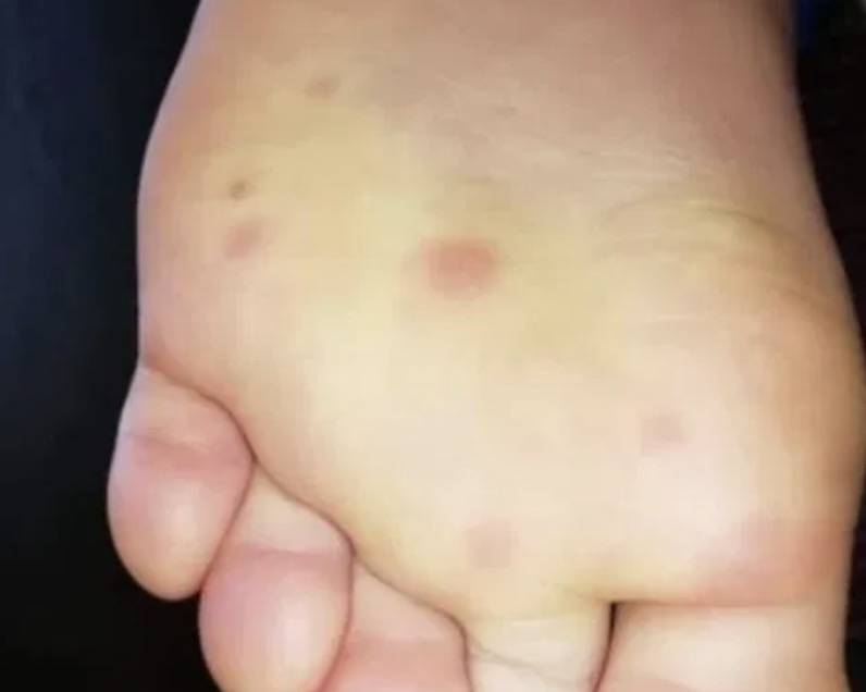 新加坡机场员工紧急检测!曝感染新冠后可能会出现这14种症状