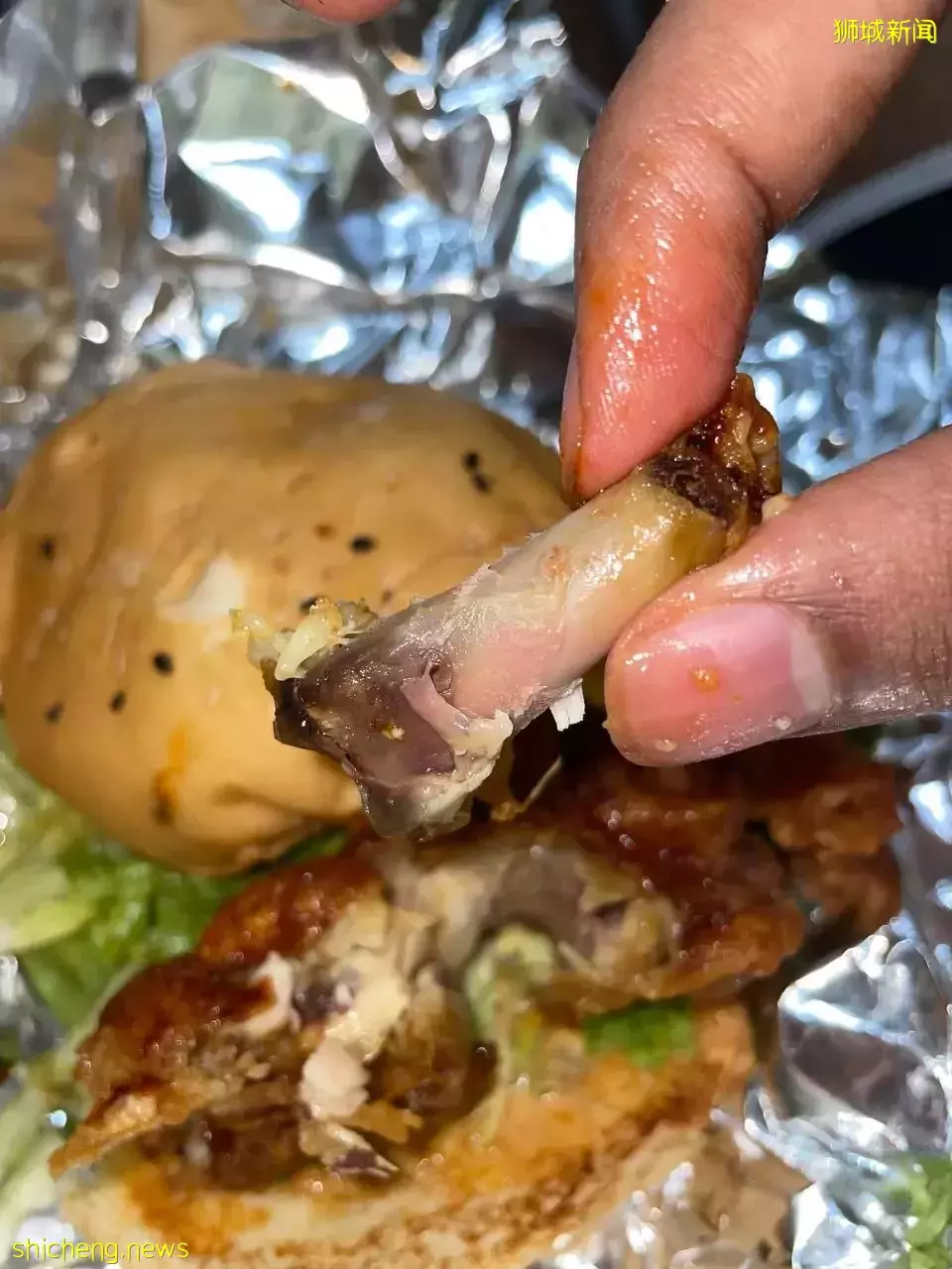 吃汉堡咬到鸡骨头 2狮城男子牙齿险咬断
