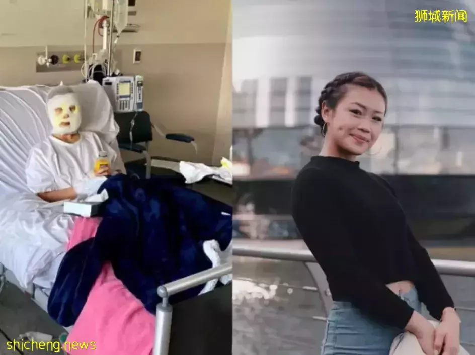 新加坡燒傷“幸存者”Chew，被美國真人秀明星卡戴珊稱爲"女王"