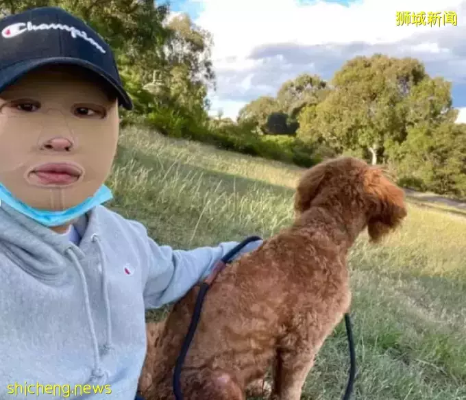 新加坡燒傷“幸存者”Chew，被美國真人秀明星卡戴珊稱爲"女王"