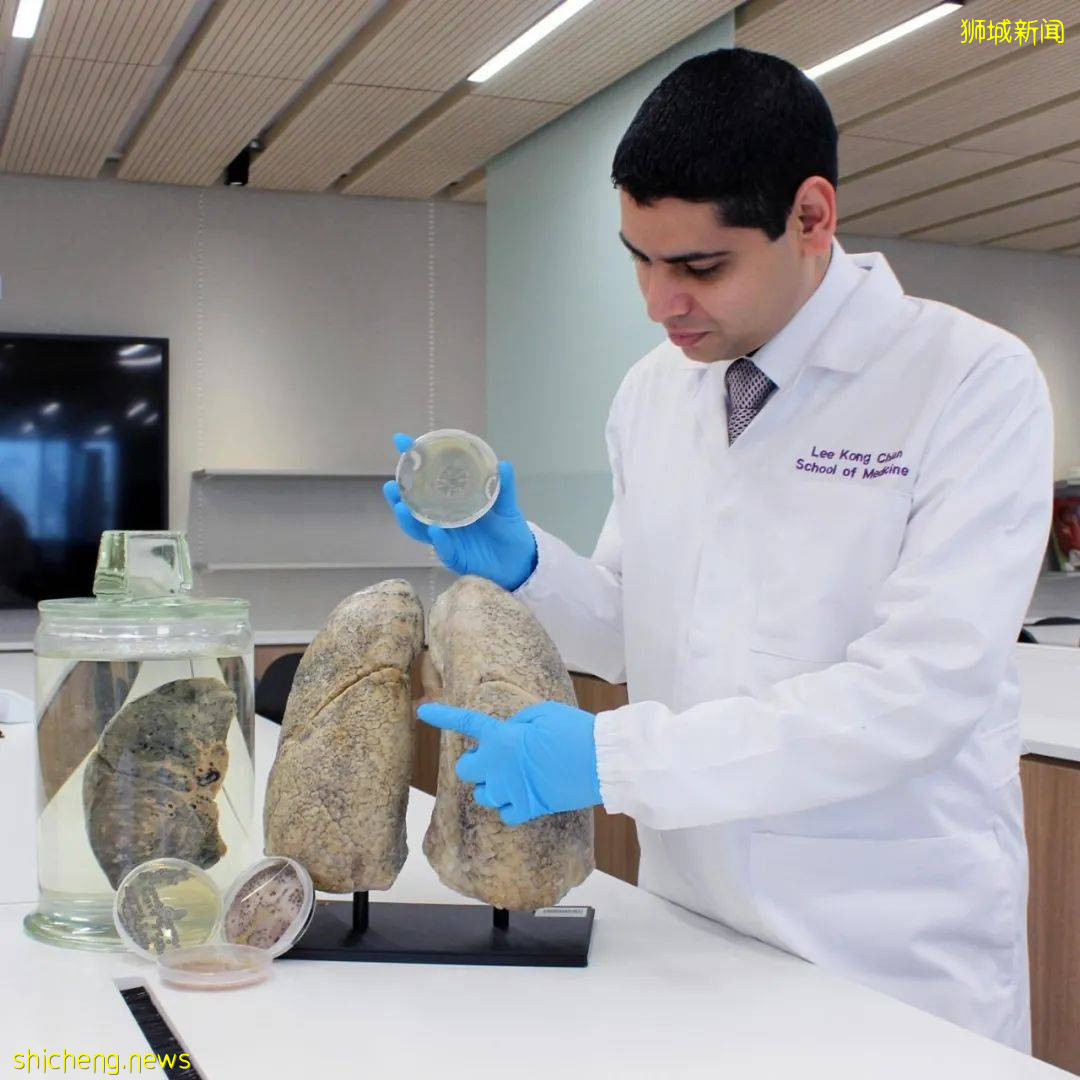 颠覆认知！NTU研究团队发现“感染”可能的新机理