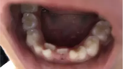 在全球最貴的新加坡，怎麽看病才能省錢？我女兒看病的這些事