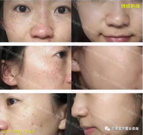 新加坡成亚洲富豪名媛聚集地!打飞的来这竟只是为了变美