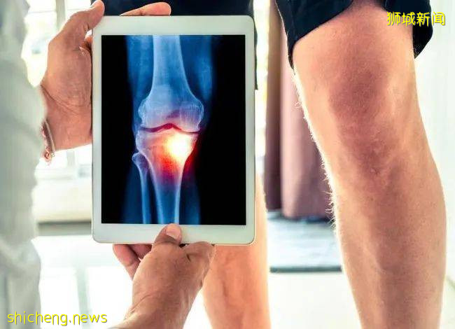 风湿病肆虐新加坡，我们该如何预防