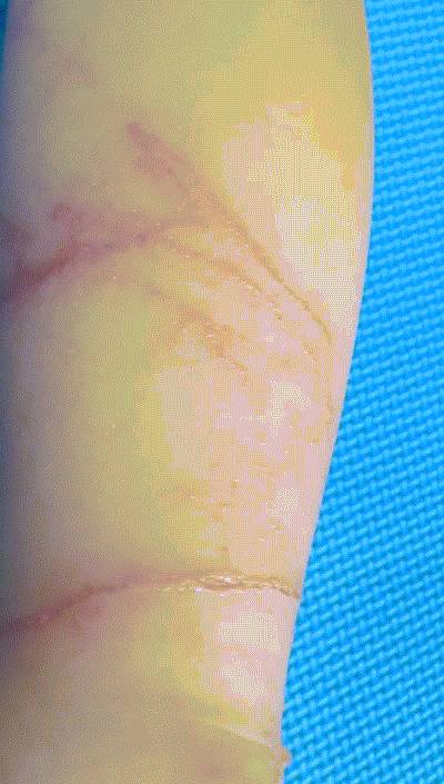 有毒水母泛濫新加坡海灘！聖淘沙禁止遊泳，巴西立海邊也有