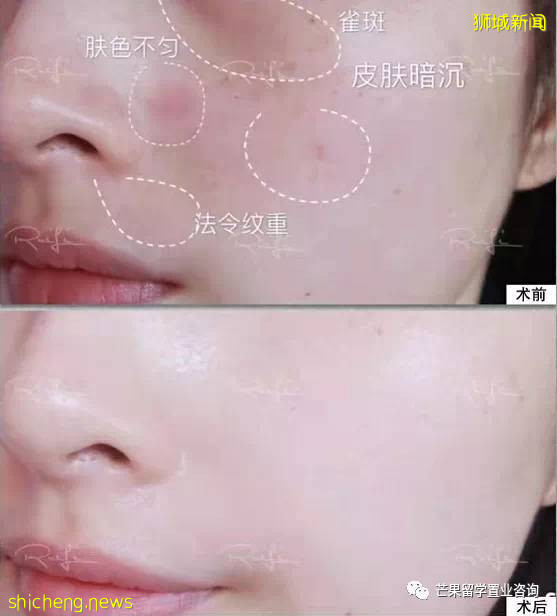 新加坡成亚洲富豪名媛聚集地!打飞的来这竟只是为了变美