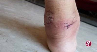 水獭滨海湾花园使坏 狠咬少妇脚踝 缝3针