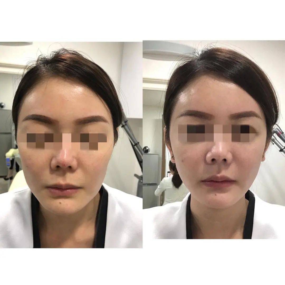 为什么那么多中国人来到新加坡后,变丑了