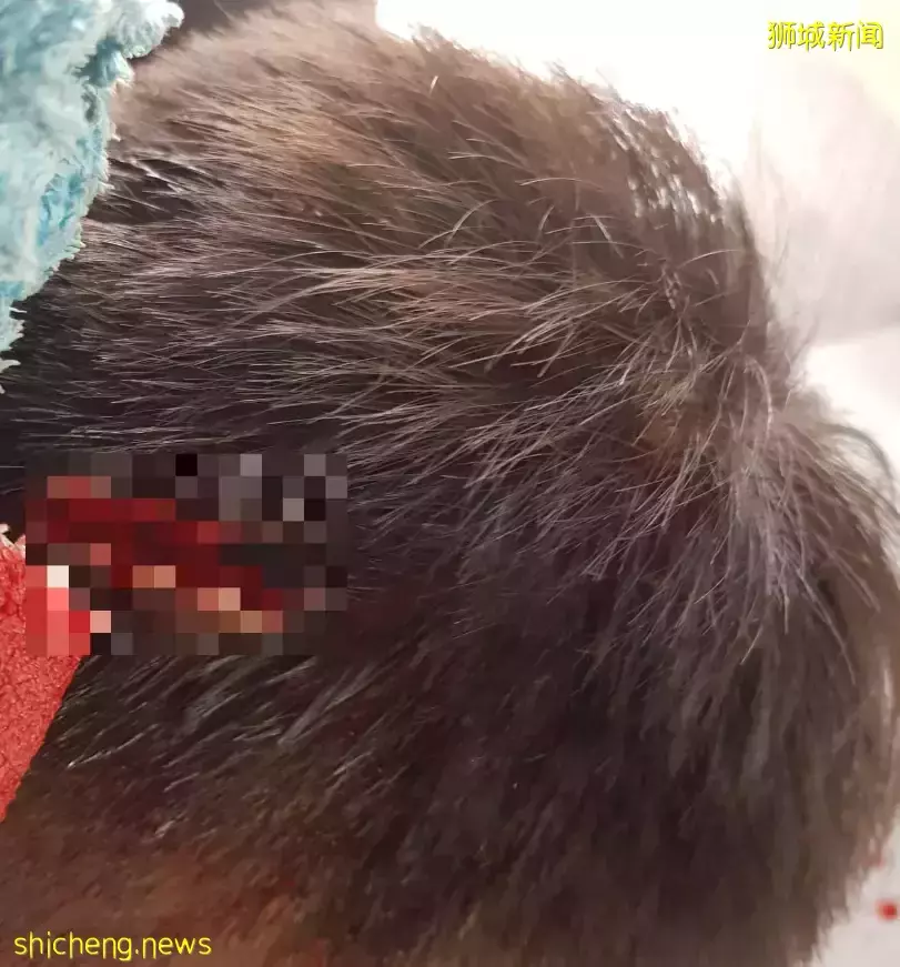 震惊!这名学生在新加坡被狂砍6刀,缝了几十针!警方高层:芽笼是潜在火药桶