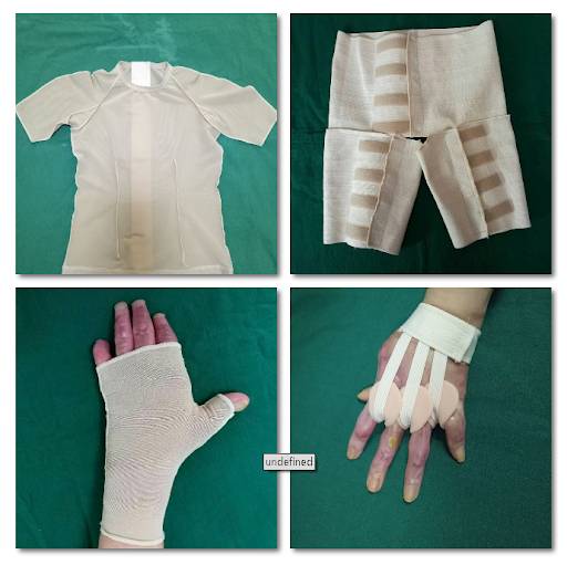 新加坡5死1伤车祸：为救男友80%烧伤的美女歌星，刚脱离危险！她还得面对这些