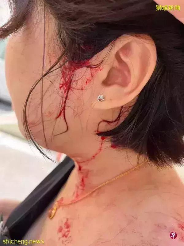 组屋有盖走廊天花板修了再修，仍脱落砸中路过52岁妇女令她头破血流