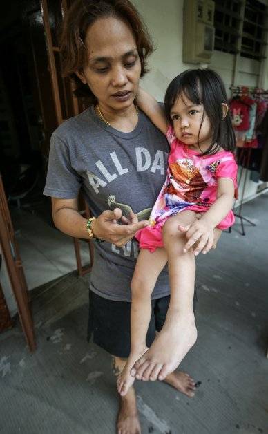 讨论装电眼 意外就来了 电动踏板车压伤女童