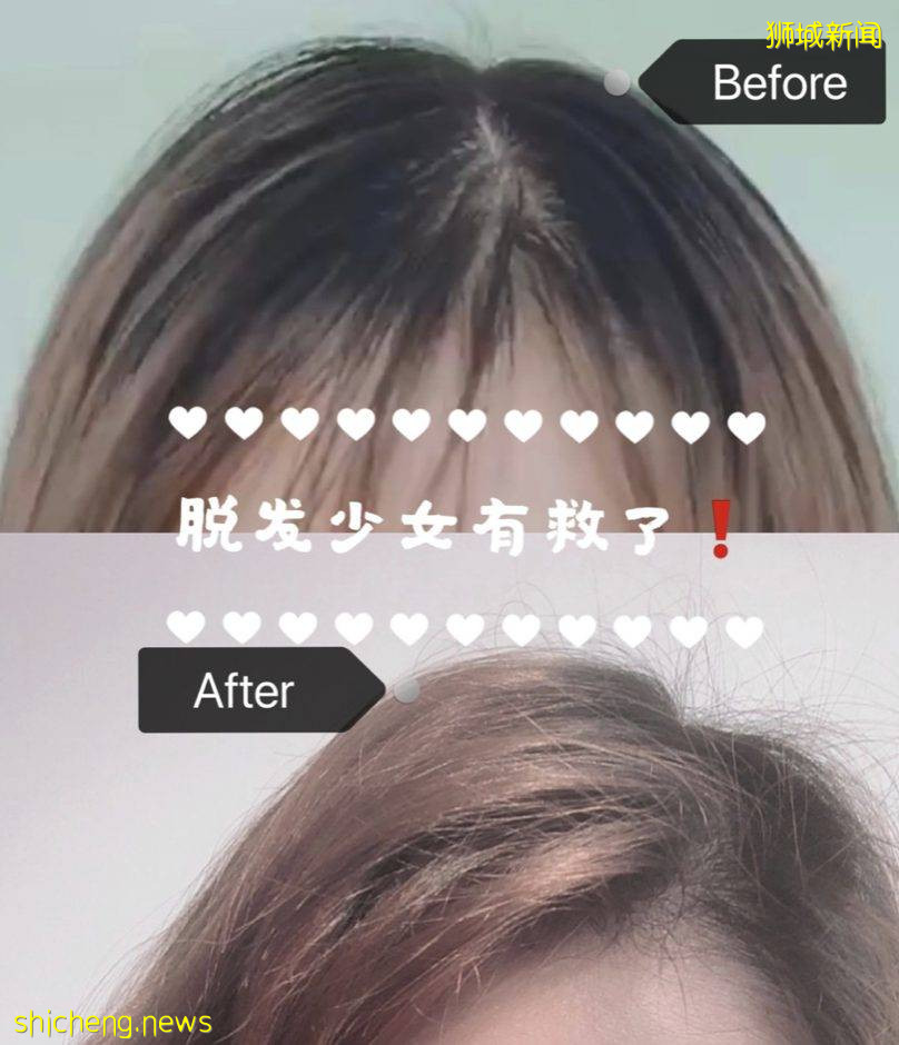 買美容儀趁現在！雙十一超好價來啦！熱門美容儀大科普，教你怎樣挑選最適合自己的美容儀