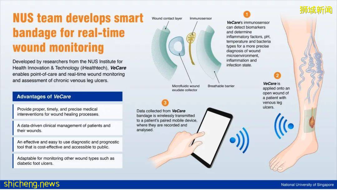 NUS研发出智能绷带,帮助慢性伤口恢复