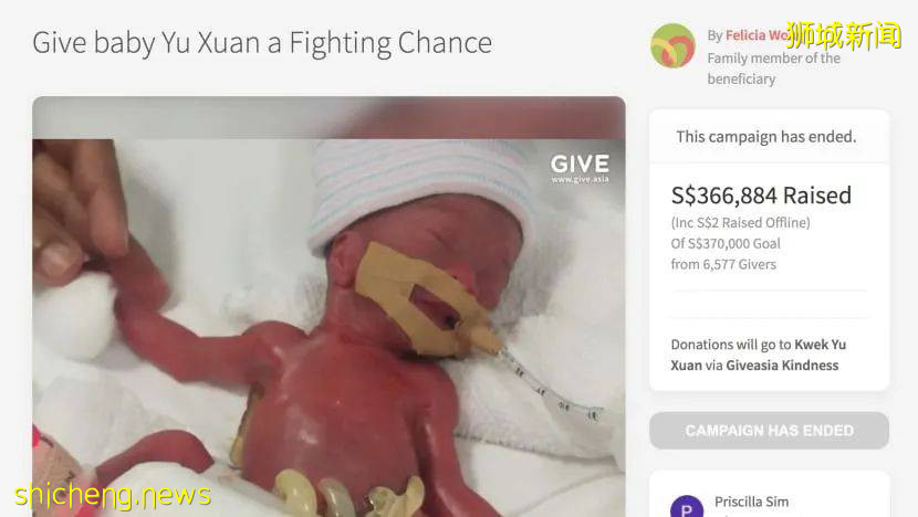 全世界最輕早産兒在新加坡出生,住院13個月後成功回家