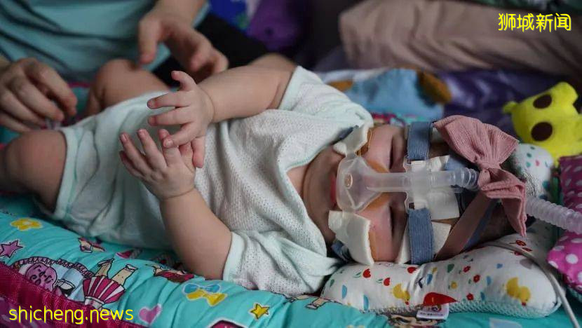 全世界最輕早産兒在新加坡出生,住院13個月後成功回家