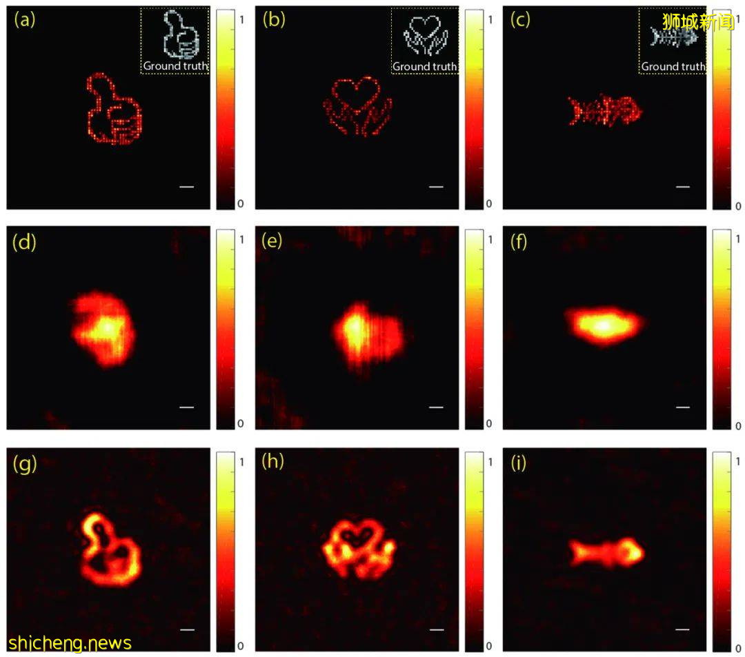 南大学者开发新技术!无需显微镜即可研究皮下细胞