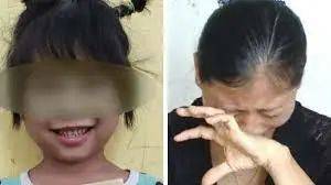 5歲女童拔牙後腦死亡!你還敢隨便在新加坡給孩子拔牙嗎