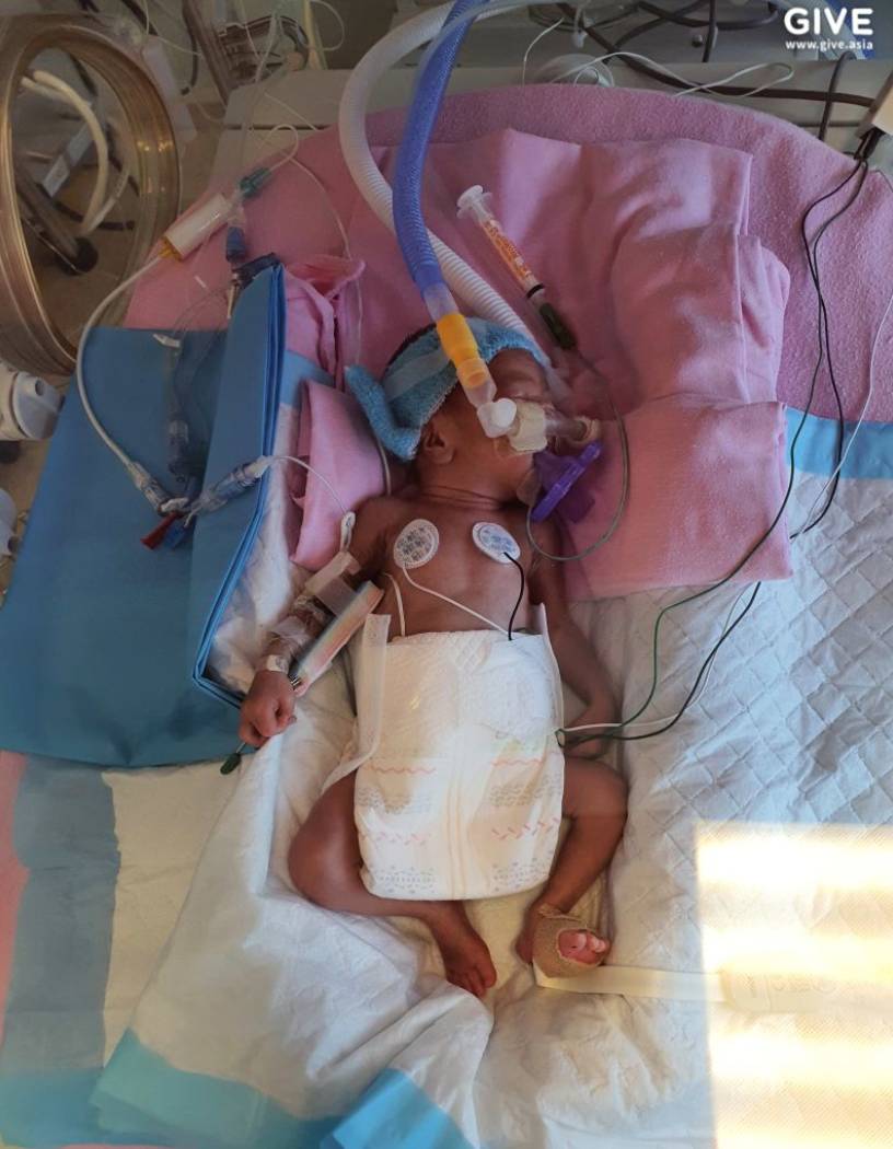 因誕下早産兒,這對馬來西亞夫婦在新加坡傾家蕩産