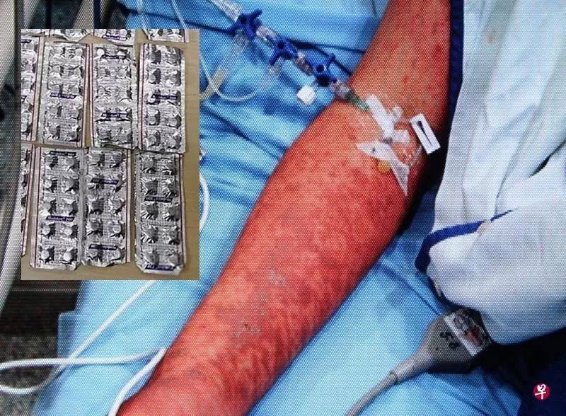 吃了“聪明药” 不变聪明反遭罪