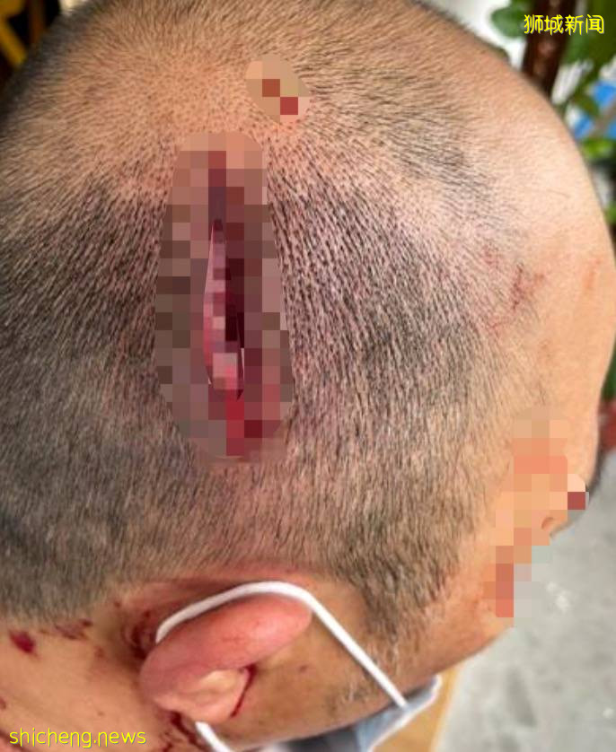 宏茂橋驚現鄰裏傷人案！一男子擦窗時被鄰居用鐵鏈爆頭