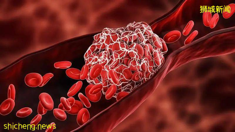 2976例，死亡11人，破13萬感染！部長：新加坡確診增速放緩，措施奏效